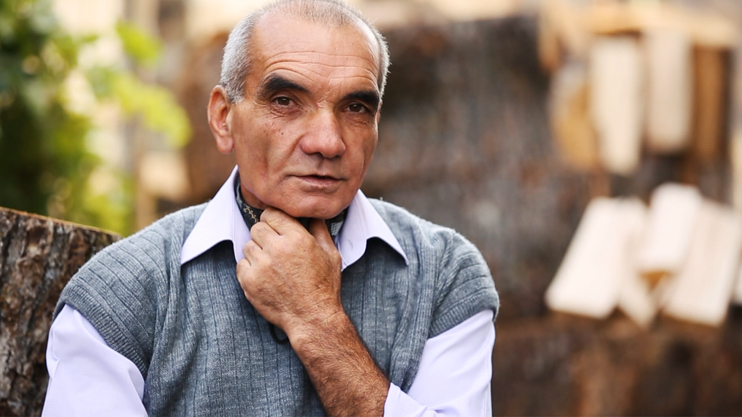 Smoking may cause vocal cords cancer
