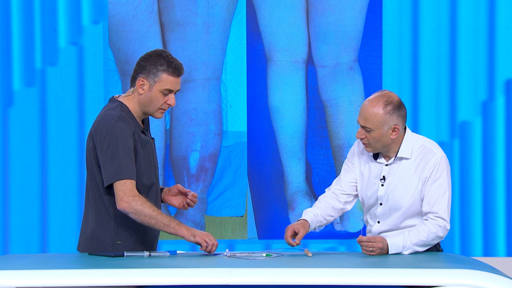 Be Healthy! Varicose Veins