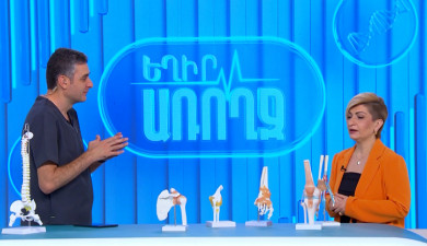 Be Healthy: Arthritis